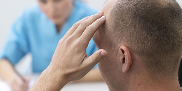 ALOPECIA (CADUTA DEI CAPELLI): CAUSE E RIMEDI