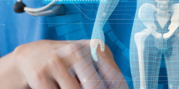 Le nostre ossa: a cosa servono, perché sono importanti, come preservarle